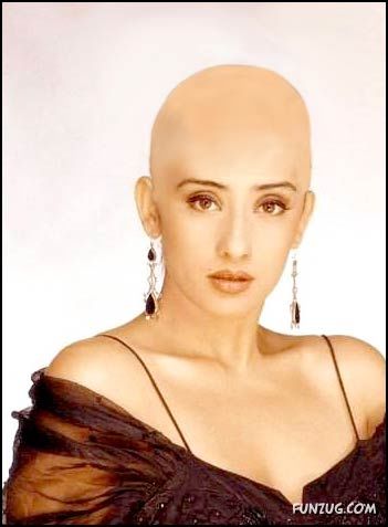 What If Your Favourite Celeb Go Bald? 