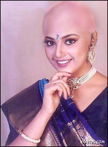 What If Your Favourite Celeb Go Bald? 