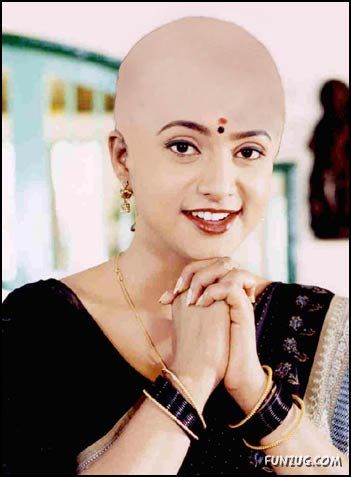 What If Your Favourite Celeb Go Bald? 