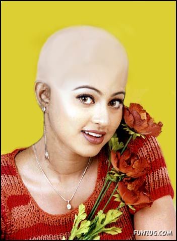 What If Your Favourite Celeb Go Bald? 