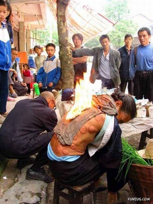 Crazy Street Doctor In China